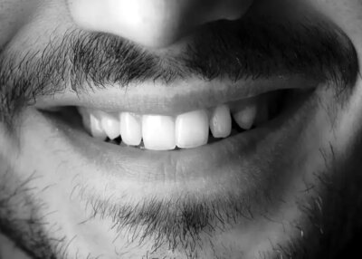 CHU de Nantes : quand les soins dentaires s'adaptent enfin aux patients les plus fragiles