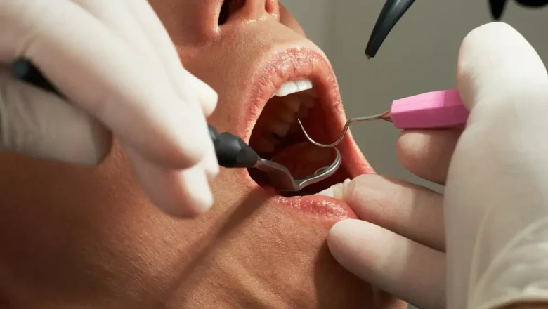 Nantes : cinq chirurgiens-dentistes licenciés chez VYV3, Force Ouvrière dénonce une procédure "menée à marche forcée"
